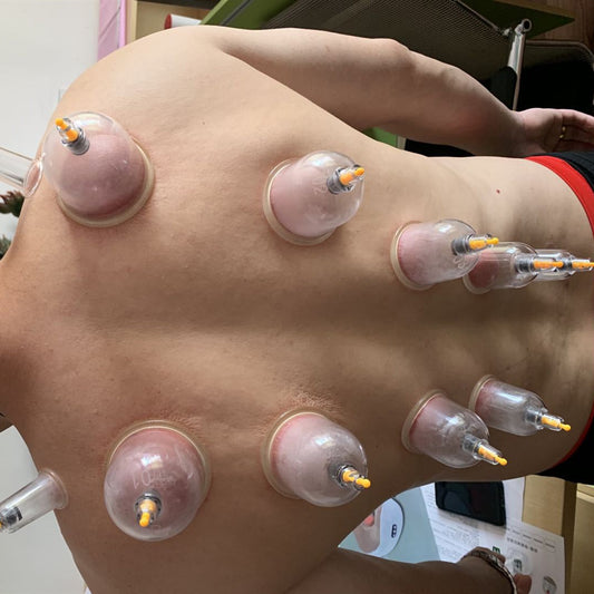 Vacuum Electric Cupping Device Household Suction Type